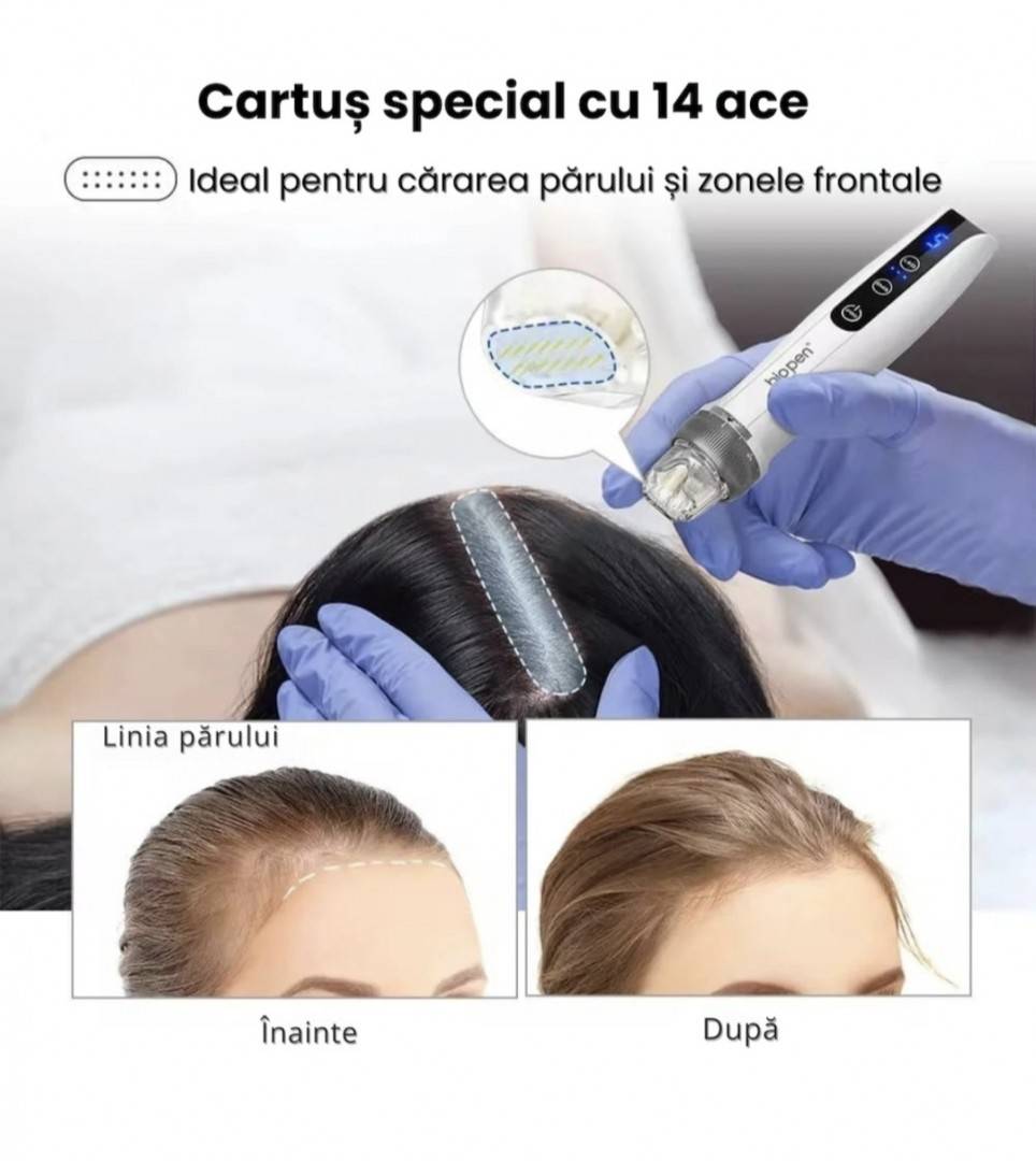 Bio Pen Q2 - ( Dr Pen ) 3-in-1 cu Microneedling, LED si EMS dispozitiv pentru fata si tratamente impotriva caderii parului - CADOU - 6 ace