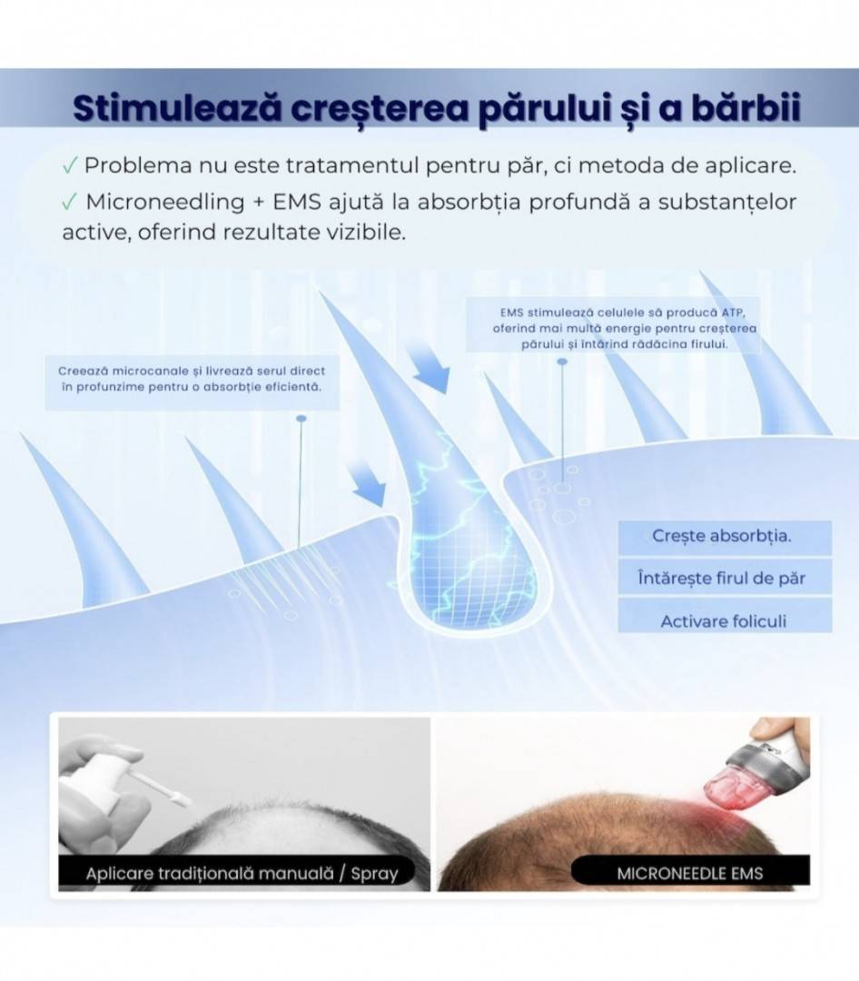 Bio Pen Q2 - ( Dr Pen ) 3-in-1 cu Microneedling, LED si EMS dispozitiv pentru fata si tratamente impotriva caderii parului - CADOU - 6 ace