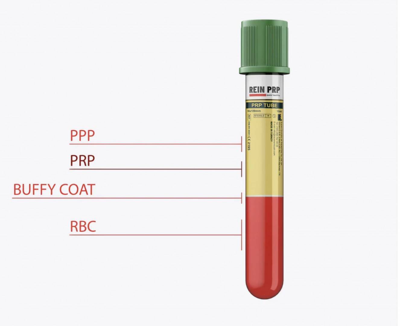 Eprubeta PRP - REIN - cu Anticoagulant ( fara gel ) - 10 ml x 5 bucati